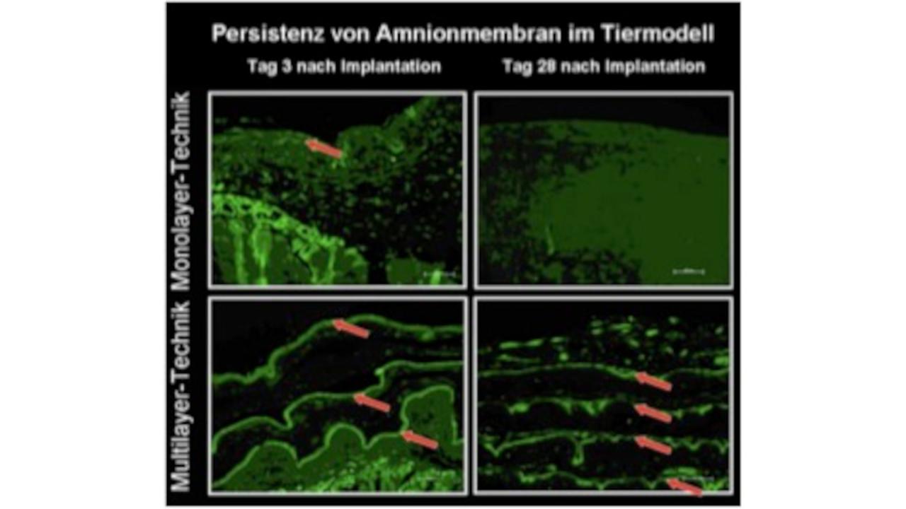 amnionmembran amnionmembran