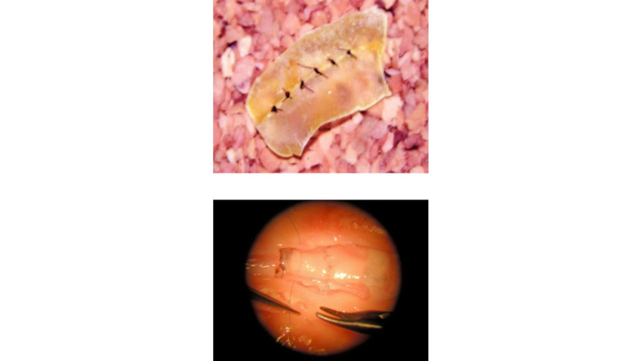 microsurgery microsurgery